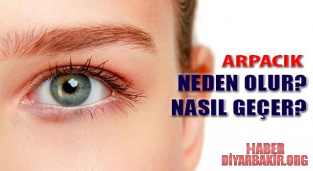 Arpacık Nedir