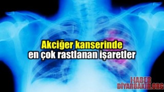 Akciğer Kanseri Nedir